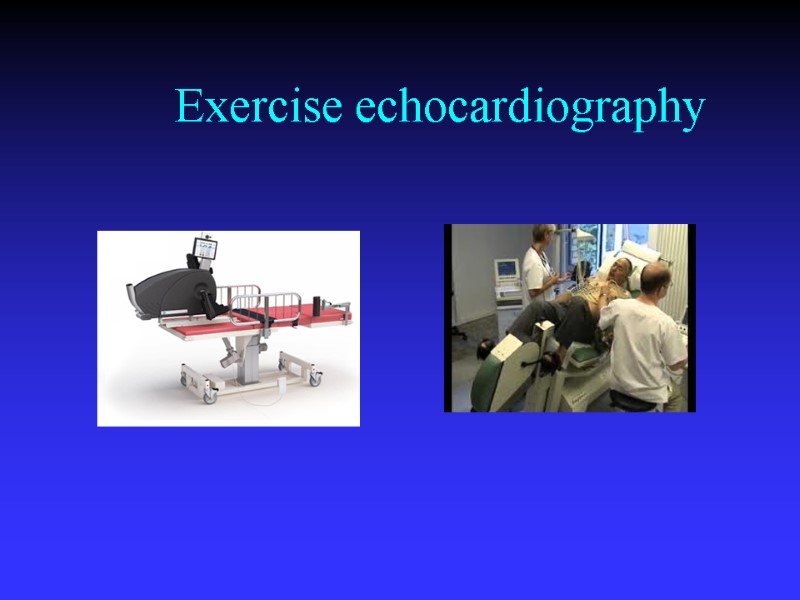 Exercise echocardiography